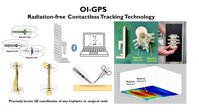 Silver Medal: Non-contact, non-radiation device that accurately locates multiple implants in a patient's body